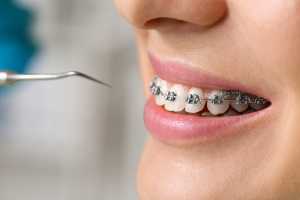 brackets