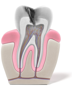 endodoncia