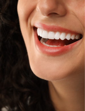 estética dental