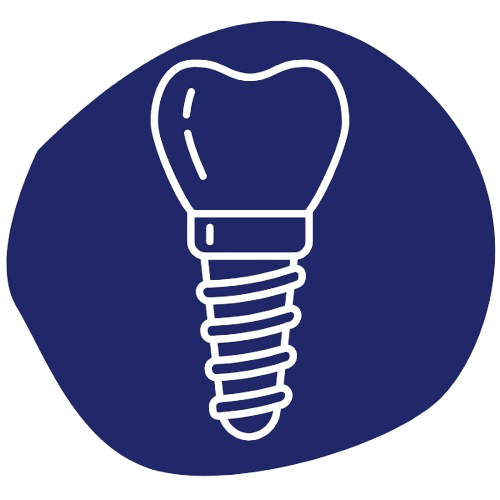 implantes_dentales